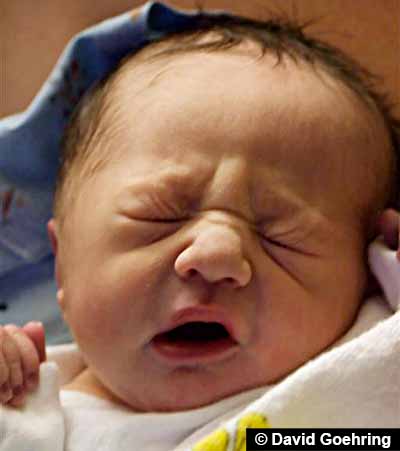 Facial expression folds on newborn